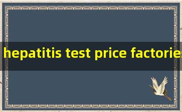 hepatitis test price factories